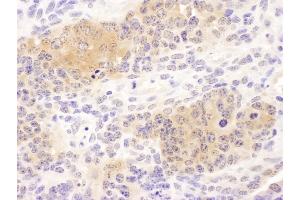 Immunohistochemistry (IHC) image for anti-Chaperonin Containing TCP1, Subunit 8 (Theta) (CCT8) (AA 448-498) antibody (ABIN7453620) (CCT8 Antikörper  (AA 448-498))