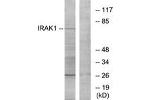 Western blot analysis of extracts from NIH-3T3 cells, using IRAK1 (Ab-209) Antibody. (IRAK1 Antikörper  (AA 175-224))