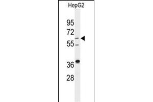 Western blot analysis of anti-DHCR24 Antibody (Center) (ABIN389353 and ABIN2839459) in HepG2 cell line lysates (35 μg/lane). (Seladin 1 Antikörper  (AA 218-246))