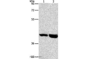 Western blot analysis of Mouse heart and liver tissue, using GPR182 Polyclonal Antibody at dilution of 1:1000 (G Protein-Coupled Receptor 182 Antikörper)