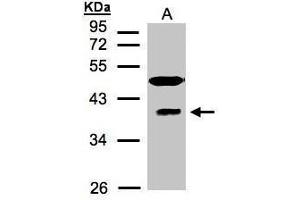 WB Image Sample(30 μg of whole cell lysate) A:HeLa S3, 12% SDS PAGE antibody diluted at 1:1500