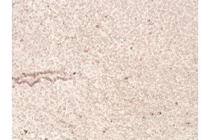 Immunohistochemistry analysis of human tonsil tissue (20x) using LAG-3 (human) recombinant mAb (L4-PL33), at a dilution of 1:50. (LAG3 Antikörper  (N-Term))