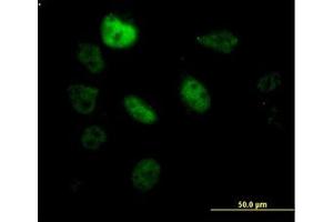 Image no. 1 for anti-Splicing Factor 3b, Subunit 2, 145kDa (SF3B2) (AA 592-646) antibody (ABIN599162) (SF3B2 Antikörper  (AA 592-646))