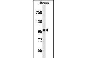 FGD4 Antibody (N-term) (ABIN656907 and ABIN2846104) western blot analysis in human normal Uterus tissue lysates (35 μg/lane). (FGD4 Antikörper  (N-Term))