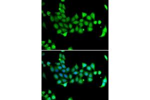 Immunofluorescence analysis of A549 cells using HSPA14 antibody. (HSPA14 Antikörper  (AA 240-509))