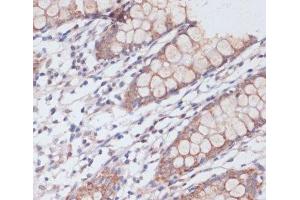 Immunohistochemistry of paraffin-embedded Human colon using MBTPS1 Polyclonal Antibody at dilution of 1:100 (40x lens). (MBTPS1 Antikörper)