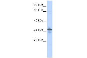 RPIA antibody used at 1 ug/ml to detect target protein. (Ribose 5-Phosphate Isomerase A (RPIA) Antikörper)