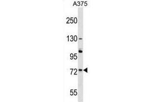 ACOX2 Antibody (N-term) western blot analysis in A375 cell line lysates (35 µg/lane). (Acox2 Antikörper  (N-Term))