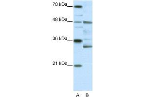 WB Suggested Anti-HTLF Antibody Titration:  0. (FOXN2 Antikörper  (N-Term))