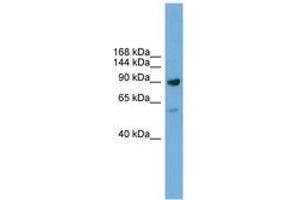Image no. 1 for anti-DEAD (Asp-Glu-Ala-Asp) Box Polypeptide 54 (DDX54) (AA 751-800) antibody (ABIN6744608) (DDX54 Antikörper  (AA 751-800))