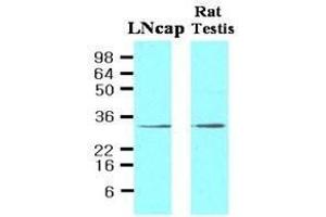 Cell lysates of LNcap (30ug) and Rat testis (30ug) were resolved by SDS-PAGE, transferred to NC membrane and probed with anti-human STEAP1 (1:500). (STEAP1 Antikörper  (AA 1-70))