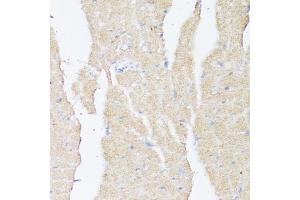 Immunohistochemistry (IHC) image for anti-Bone Morphogenetic Protein Receptor, Type II (serine/threonine Kinase) (BMPR2) (AA 27-150) antibody (ABIN7265906)