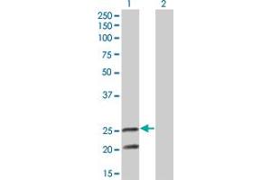 Western Blot analysis of IL6 expression in transfected 293T cell line by IL6 monoclonal antibody (M05), clone 3E8. (IL-6 Antikörper  (AA 29-212))