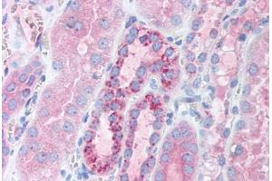 Human Kidney (formalin-fixed, paraffin-embedded) stained with TFAM antibody ABIN214152 at 5 ug/ml followed by biotinylated goat anti-rabbit IgG secondary antibody ABIN481713, alkaline phosphatase-streptavidin and chromogen. (TFAM Antikörper  (AA 75-124))