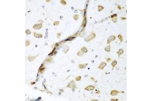 Immunohistochemistry of paraffin-embedded mouse brain using ELAVL2 antibody at dilution of 1:200 (40x lens).