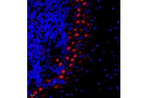 Immunofluorescence of paraffin embedded mouse cerebellum using USP27 (ABIN7076113) at dilution of 1:1500 (400x lens) (USP27X Antikörper)