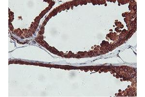 Immunohistochemical staining of paraffin-embedded Human breast tissue using anti-C20orf3 mouse monoclonal antibody. (APMAP Antikörper)