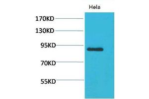 Western Blot (WB) analysis of HeLa using Stat4 Polyclonal Antibody. (STAT4 Antikörper)