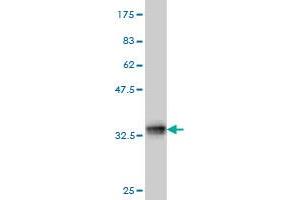 Western Blotting (WB) image for anti-Treacher Collins-Franceschetti Syndrome 1 (TCOF1) (AA 2-82) antibody (ABIN563126)