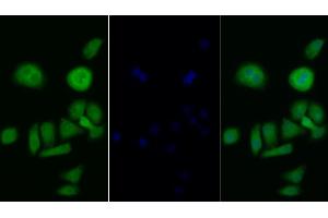 Detection of PIK3Cb in Human Hela cell using Polyclonal Antibody to Phosphoinositide-3-Kinase Catalytic Beta Polypeptide (PIK3Cb) (PIK3CB Antikörper  (AA 524-703))