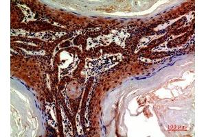 Immunohistochemistry (IHC) analysis of paraffin-embedded Human Skin, antibody was diluted at 1:200. (ADAMTS18 Antikörper)