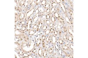 Immunohistochemistry (IHC) image for anti-Coactivator-Associated Arginine Methyltransferase 1 (CARM1) (AA 409-608) antibody (ABIN1682307)