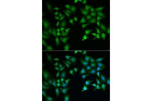 Immunofluorescence analysis of A549 cell using FLOT2 antibody. (Flotillin 2 Antikörper)