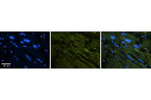 Immunohistochemistry (IHC) image for anti-Sodium Channel, Voltage-Gated, Type V, alpha Subunit (SCN5A) (C-Term) antibody (ABIN2776089)