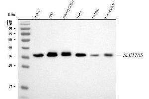 Western blot analysis of SLC17A5 using anti-SLC17A5 antibody (ABIN7599315).