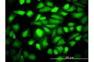 Immunofluorescence (IF) image for anti-DnaJ (Hsp40) Homolog, Subfamily B, Member 6 (DNAJB6) (AA 1-241) antibody (ABIN564339)