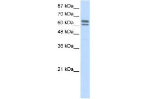 WB Suggested Anti-BTBD14B Antibody Titration:  5.