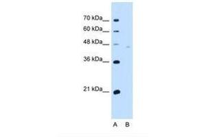 Image no. 2 for anti-Neuroplastin (NPTN) (AA 201-250) antibody (ABIN321178) (NPTN Antikörper  (AA 201-250))