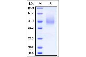 Mouse B7-2, His Tag on SDS-PAGE under reducing (R) condition. (CD86 Protein (CD86) (AA 24-245) (His tag))