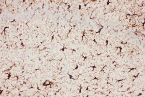 Anti-GFAP Picoband antibody,  IHC(P): Mouse Brain Tissue (GFAP Antikörper  (AA 93-432))