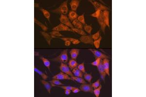 Immunofluorescence analysis of NIH-3T3 cells using CaMKII delta Rabbit mAb (ABIN7266019) at dilution of 1:100 (40x lens). (CAMK2D Antikörper)