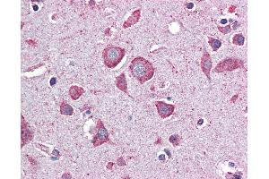 Immunohistochemistry (IHC) image for anti-Eukaryotic Translation Initiation Factor 2B, Subunit 2 Beta, 39kDa (EIF2B2) (AA 1-352) antibody (ABIN790635)