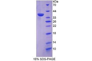 Image no. 1 for Dual Specificity Phosphatase 6 (DUSP6) (AA 1-300) protein (His tag) (ABIN4990495) (DUSP6 Protein (AA 1-300) (His tag))