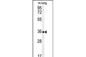 Western blot analysis of CA4 Antibody (C-term) (ABIN391691 and ABIN2841596) in mouse lung tissue lysates (35 μg/lane). (CA4 Antikörper  (C-Term))