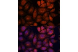 Immunofluorescence analysis of HeLa cells using KIF13A antibody (ABIN7268122) at dilution of 1:100. (KIF13A Antikörper  (AA 1300-1600))