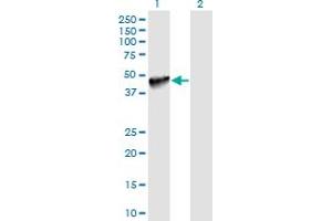 Western Blot analysis of PDCD1LG2 expression in transfected 293T cell line by PDCD1LG2 monoclonal antibody (M06), clone 7D5. (PDCD1LG2 Antikörper  (AA 22-111))