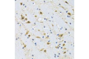 Immunohistochemistry of paraffin-embedded mouse brain using CCT4 antibody (ABIN2561655) at dilution of 1:100 (40x lens). (CCT4 Antikörper)