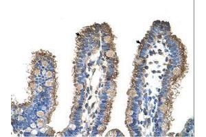 Image no. 1 for anti-rho-Related BTB Domain Containing 1 (RHOBTB1) (C-Term) antibody (ABIN6736347) (RHOBTB1 Antikörper  (C-Term))