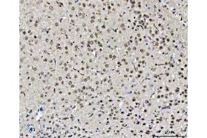 IHC analysis of CHD2 using anti-CHD2 antibody (ABIN5518901). (CHD2 Antikörper  (AA 1124-1351))
