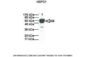 Western Blotting (WB) image for anti-Heat Shock 60kDa Protein 1 (Chaperonin) (HSPD1) (C-Term) antibody (ABIN2792215) (HSPD1 Antikörper  (C-Term))