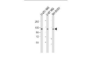 All lanes : Anti-SH3PXD2B Antibody (C-Term) at 1:2000 dilution Lane 1: U-251 MG whole cell lysate Lane 2: U-87 MG whole cell lysate Lane 3: SH-SY5Y whole cell lysate Lysates/proteins at 20 μg per lane. (SH3PXD2B Antikörper  (AA 596-628))