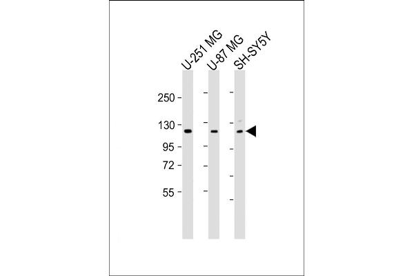 SH3PXD2B 抗体  (AA 596-628)