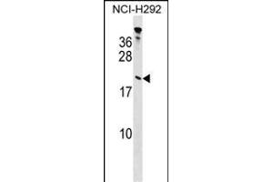 TP Antibody (Center) (ABIN1538440 and ABIN2848728) western blot analysis in NCI- cell line lysates (35 μg/lane). (Tppp Antikörper  (AA 47-75))