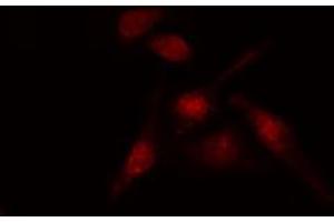 ABIN6274188 staining HT29 cells by IF/ICC. (AFT1 Antikörper  (Internal Region))