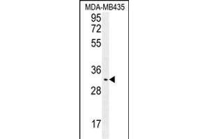 OR4K2 Antibody (C-term) (ABIN655864 and ABIN2845271) western blot analysis in MDA-M cell line lysates (35 μg/lane). (OR4K2 Antikörper  (C-Term))