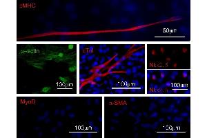 Immunofluorescence (Cultured Cells) (IF (cc)) image for anti-Cardiac Troponin C (TNNC1) (AA 131-210) antibody (ABIN728308)